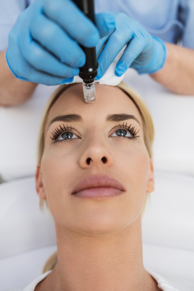 Microneedling